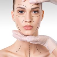 Cirugía Facial