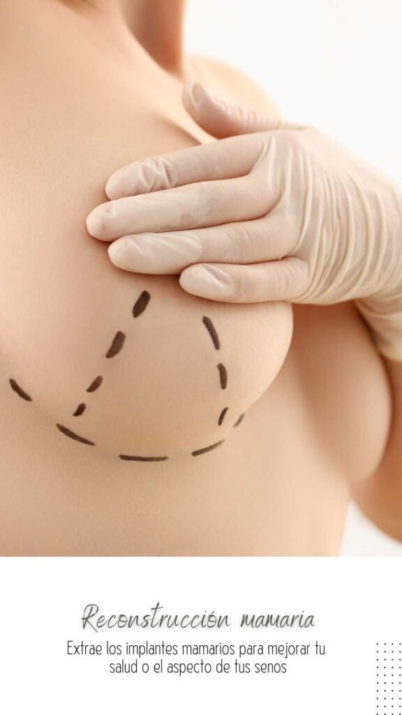 Cirugia-plastica-Cirujano-Plastico-Jarold-Effer-Taylor-procedimiento-reconstruccion-mamaria